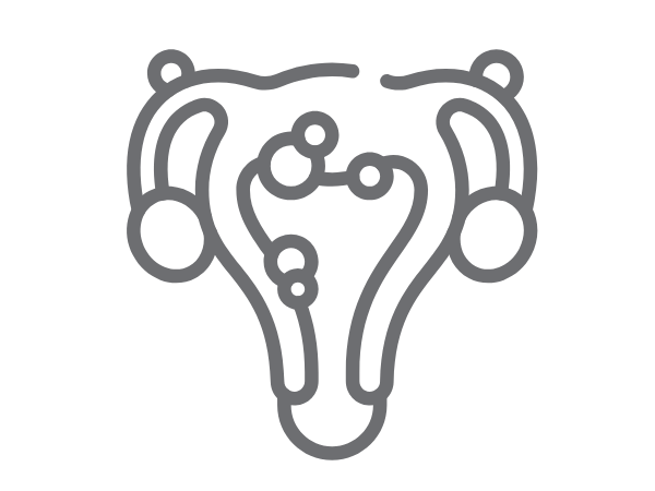 Ícone endometriose